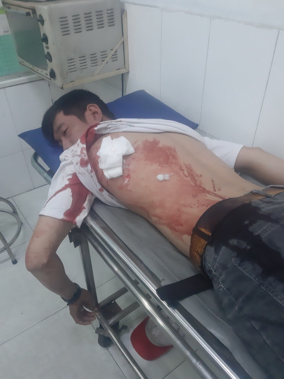 Một nhân viên của công ty tài chính bị tấn công khi thu hồi nợ tại nhà khách hàng - Ảnh 1.