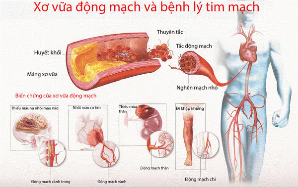 Tác dụng của khổ qua rừng đối với sức khỏe ai cũng nên biết - Ảnh 3. Tác dụng của khổ qua rừng đối với sức khỏe ai cũng nên biết - Ảnh 3.