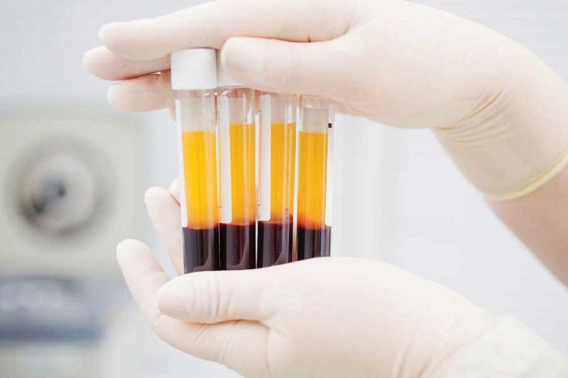 2/3 dân số Ấn Độ trên 6 tuổi có kháng thể với Covid-19: Hy vọng thảm kịch không còn tái diễn - Ảnh 2. 2/3 dân số Ấn Độ trên 6 tuổi có kháng thể với Covid-19: Hy vọng thảm kịch không còn tái diễn - Ảnh 2.