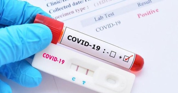 Bộ Y tế cấp phép 16 loại kit test nhanh kháng nguyên SARS-CoV-2  - Ảnh 1.