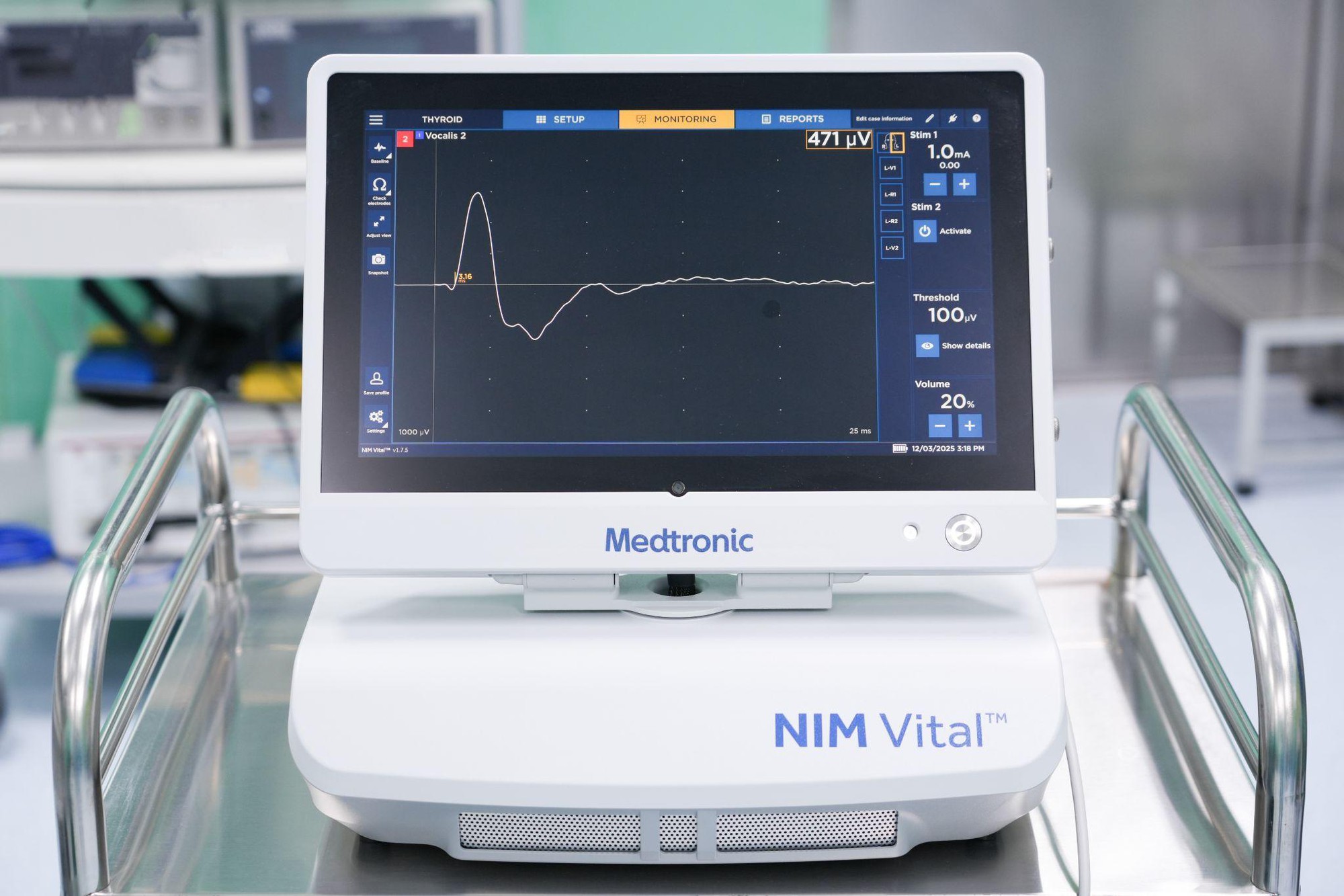 5 năm, 5 lần mổ sỏi thận - Do u tuyến cận giáp- Ảnh 3.