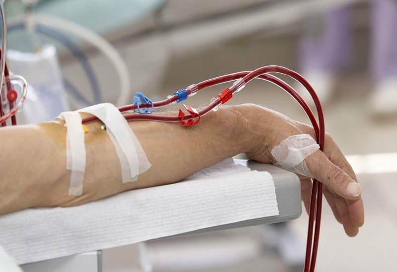 Không lọc máu nhân tạo, người bệnh suy thận sẽ ra sao chỉ sau 1 tuần?- Ảnh 1. Không lọc máu nhân tạo, người bệnh suy thận sẽ ra sao chỉ sau 1 tuần?- Ảnh 1.