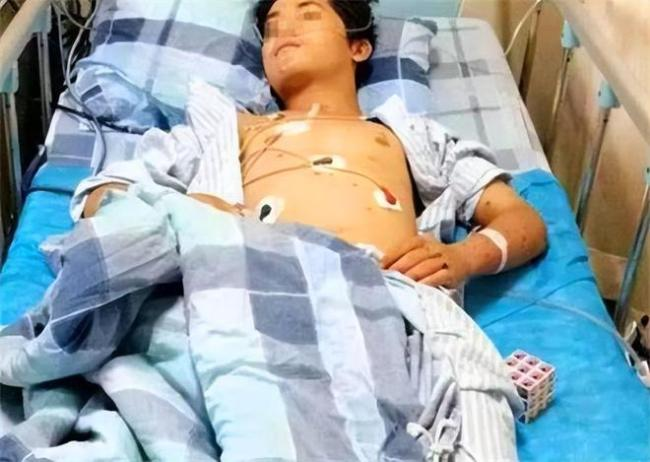 Chàng trai 17 tuổi suy thận giai đoạn cuối vì ăn quá nhiều 2 món nhưng vì "quá ngon" nên không ai từ chối- Ảnh 1. Chàng trai 17 tuổi suy thận giai đoạn cuối vì ăn quá nhiều 2 món nhưng vì "quá ngon" nên không ai từ chối- Ảnh 1.