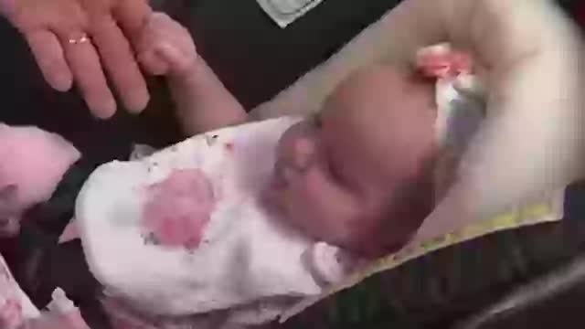 Em bé được "sinh ra hai lần" duy nhất trên thế giới- Ảnh 3.