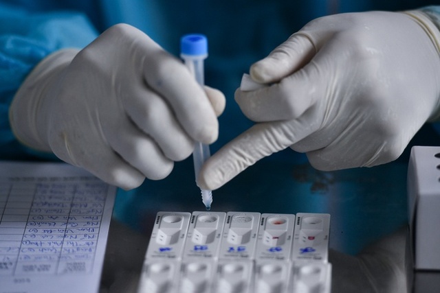 Bộ Y tế cấp phép và thông tin giá bán cho 16 loại kit test nhanh kháng nguyên SARS-CoV-2 - Ảnh 2.
