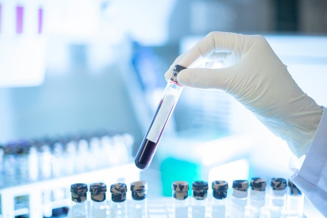 Xét nghiệm máu phát hiện sớm đa ung thư của Công ty Grail trên lộ trình xin được FDA cấp phép- Ảnh 1.