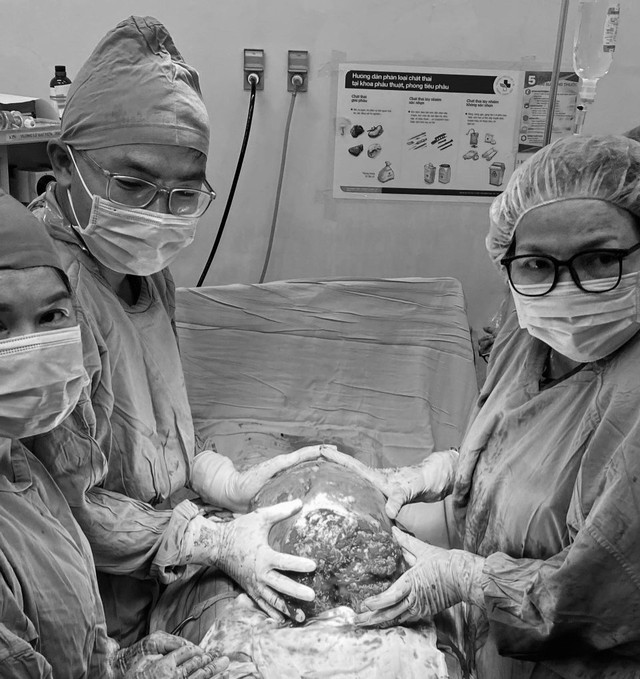 Hình ảnh ê-kíp ca phẫu thuật lấy thai song hành cắt bỏ khối u xơ nặng 6,2kg cho sản phụ.