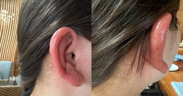 Loại khuyên tai bán chạy trên các sàn thương mại điện tử này tiềm ẩn chất độc, nên bỏ ngay kẻo hối không kịp- Ảnh 1. Loại khuyên tai bán chạy trên các sàn thương mại điện tử này tiềm ẩn chất độc, nên bỏ ngay kẻo hối không kịp- Ảnh 1.