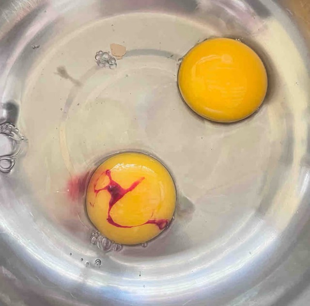 2 loại trứng gà nhiễm khuẩn - gặp là vứt ngay, 3 loại an toàn - cứ yên tâm dùng bữa!- Ảnh 5. 2 loại trứng gà nhiễm khuẩn - gặp là vứt ngay, 3 loại an toàn - cứ yên tâm dùng bữa!- Ảnh 5.