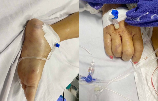 Chạy đua nghẹt thở cứu sống bệnh nhân nhiễm “sát thủ” não mô cầu Type B- Ảnh 1.