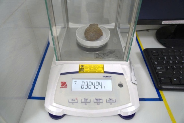 Phẫu thuật thành công cho bệnh nhân người Campuchia bị sỏi thận san hô to, khối lượng lớn- Ảnh 2.