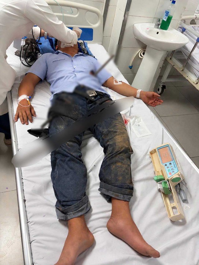 Báo động đỏ nội viện cứu sống bệnh nhân bị 2 thanh sắt xuyên thấu do tai nạn giao thông - Ảnh 1.