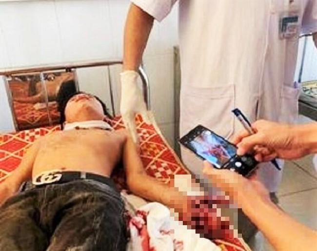 Hà Tĩnh: Laptop bất ngờ phát nổ khiến 3 học sinh phải nhập viện cấp cứu - Ảnh 1.