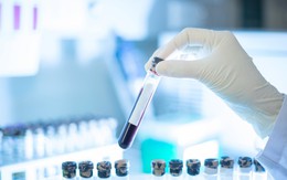 Xét nghiệm máu phát hiện sớm đa ung thư của Công ty Grail trên lộ trình xin được FDA cấp phép